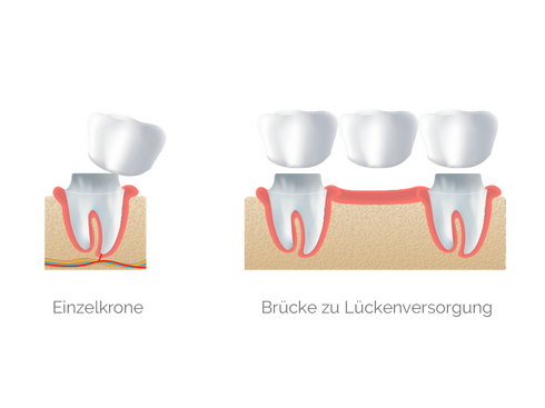 Krone & Brücken